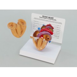Heart Model