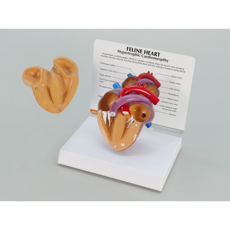 Heart Model
