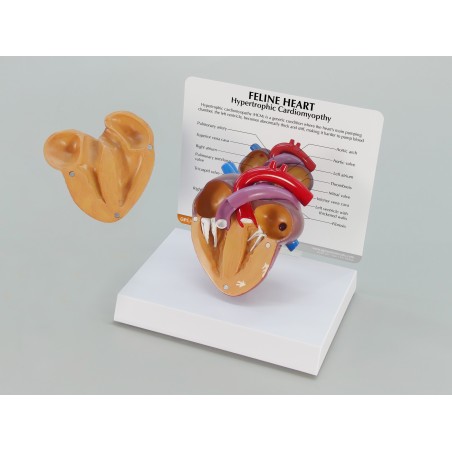 Heart Model