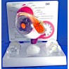 Eye Model w/ Cataracts
