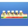 Periodontal Disease Stages Model
