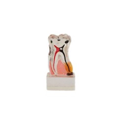 Pathological Molar Model