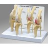 Canine 4 Stage Knee Model