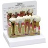 Molar Anatomy/Pathology Model