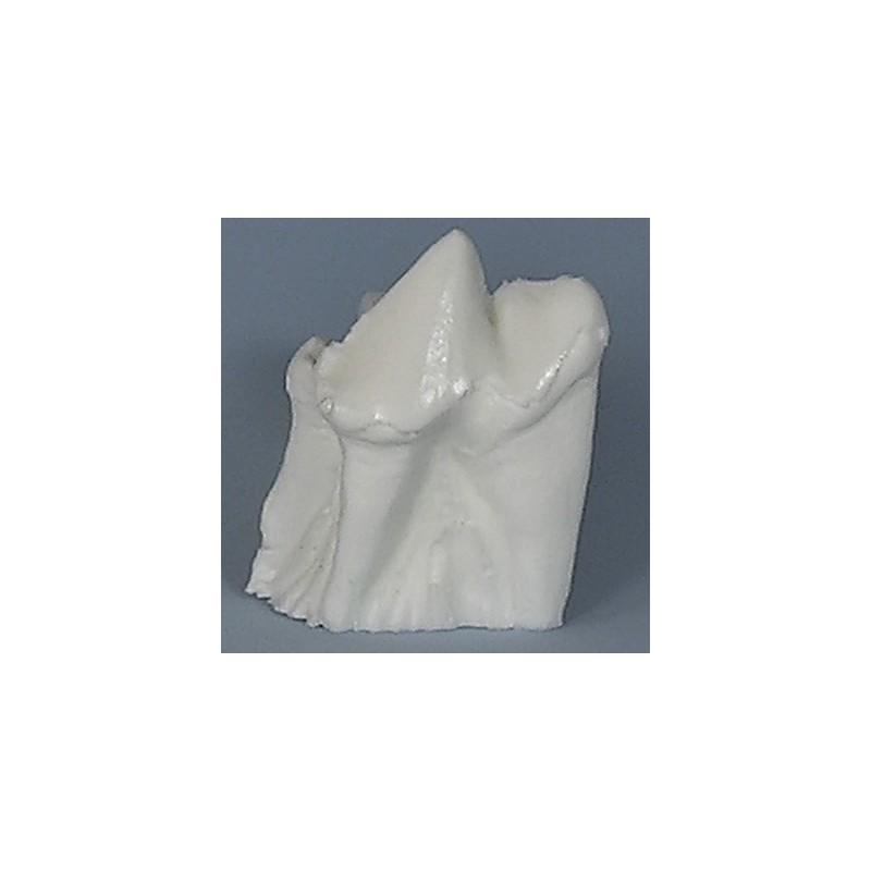 Crown Prep Practice Model