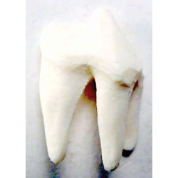 Tooth, White, replaceable (P4) (16-25)