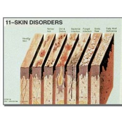 Edupad Skin disorders